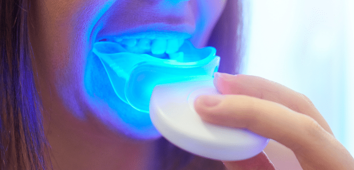 permanent teeth whitening