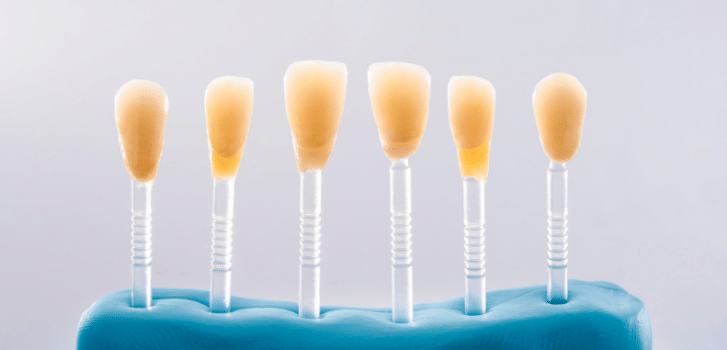 dental veneer materials