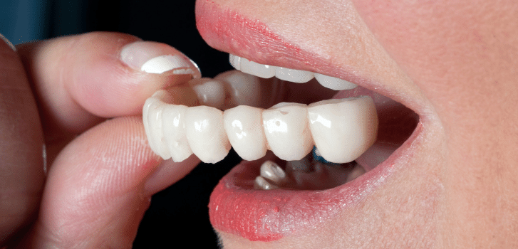 temporary teeth
